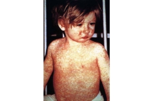 odra--CDC.NIPBarbara-Rice-GA_3280983