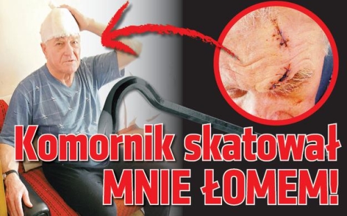 komornik-skatowal-mnie-lomem_22655132